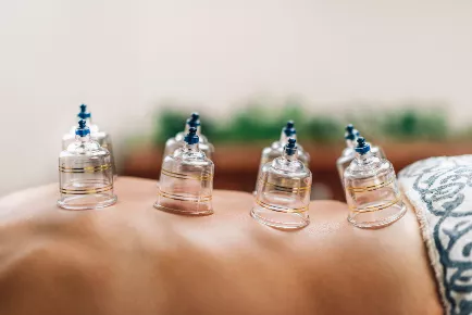 Cupping Massage