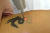 Gallery for  Yasamin Laser Clinic