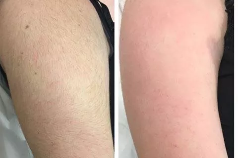 Natural Waxing Banner