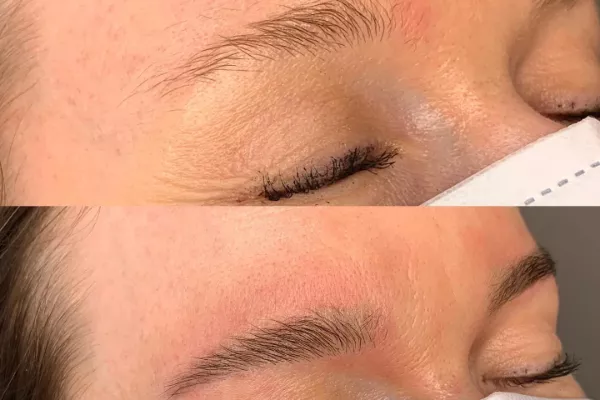 Estetica Beauty Clinic Gallery for Estetica Beauty Clinic