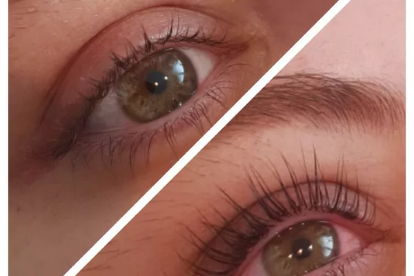 Gallery for  Fresh Beauty & Skincare Centre