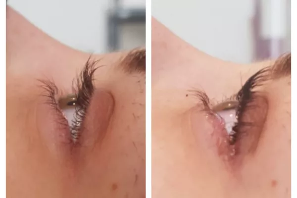 Gallery for  Fresh Beauty & Skincare Centre